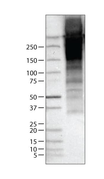 Lane 1: Marker [kDa]Lane 2: Human thyroid tissue lysate