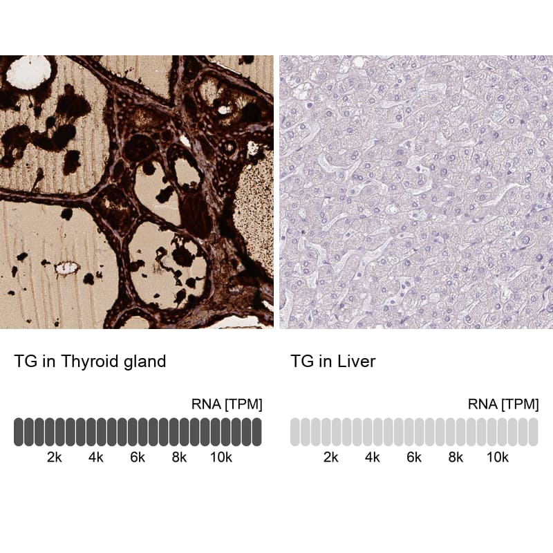 Analysis in human thyroid gland and liver tissues using NBP3-44463 antibody. Corresponding Thyroglobulin RNA-seq data are presented for the same tissues.