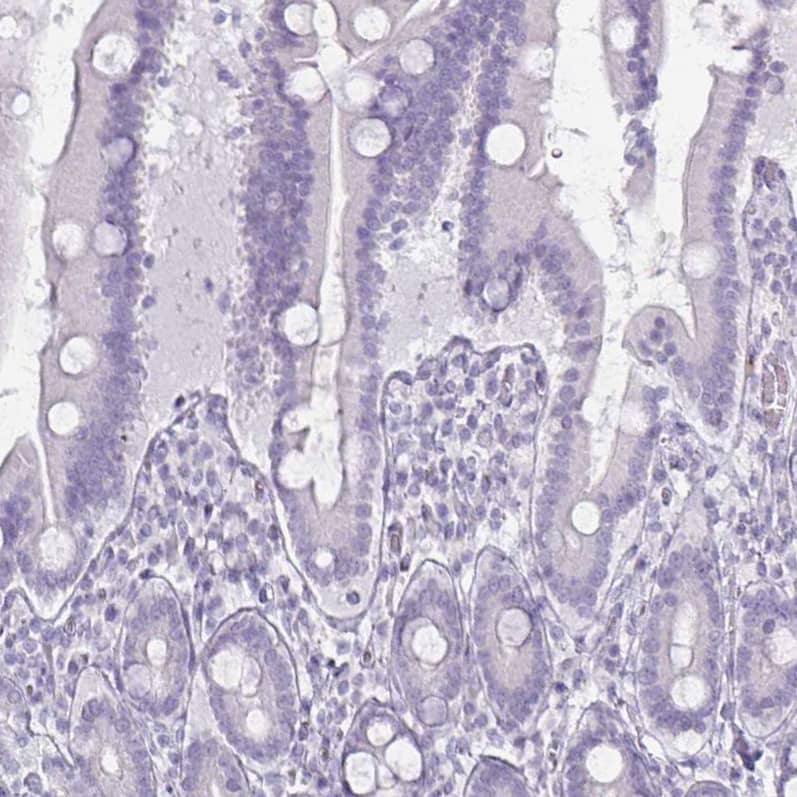 Staining of human duodenum shows no positivity in glandular cells as expected.