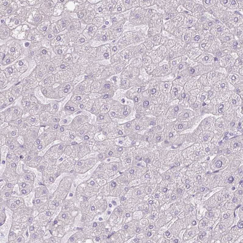Staining of human liver shows no positivity in hepatocytes as expected.