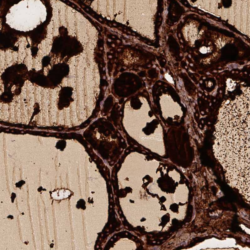 Staining of human thyroid gland shows strong cytoplasmic positivity in glandular cells.