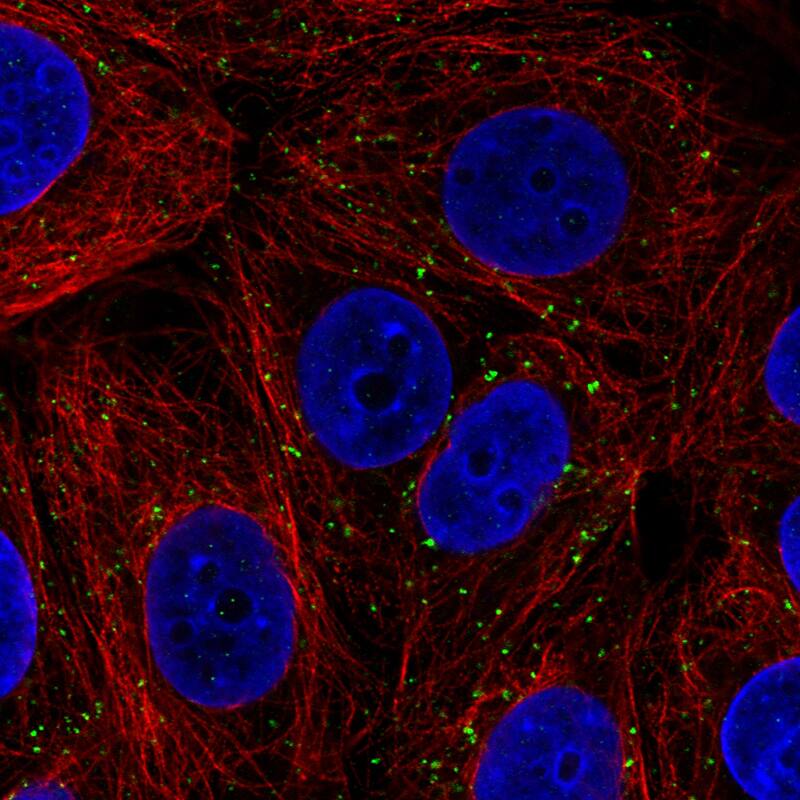 Staining in MCF7 cell line with Anti-VSP26A monoclonal antibody) .