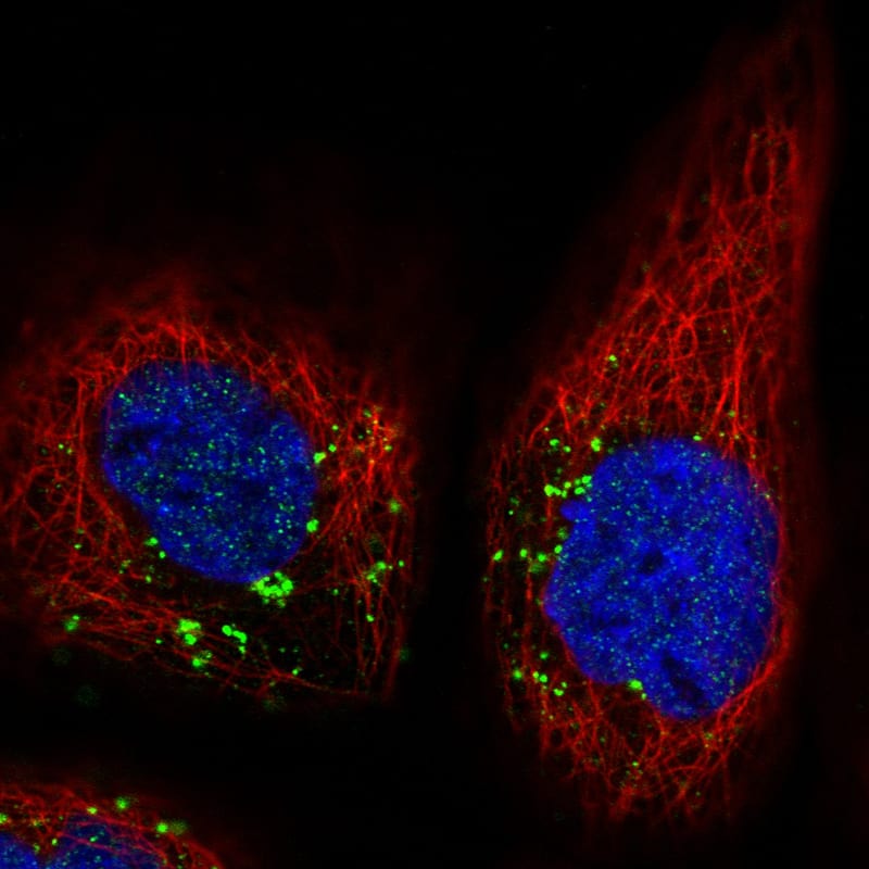 Staining in A431 cell line with Anti-VSP26A monoclonal antibody) .