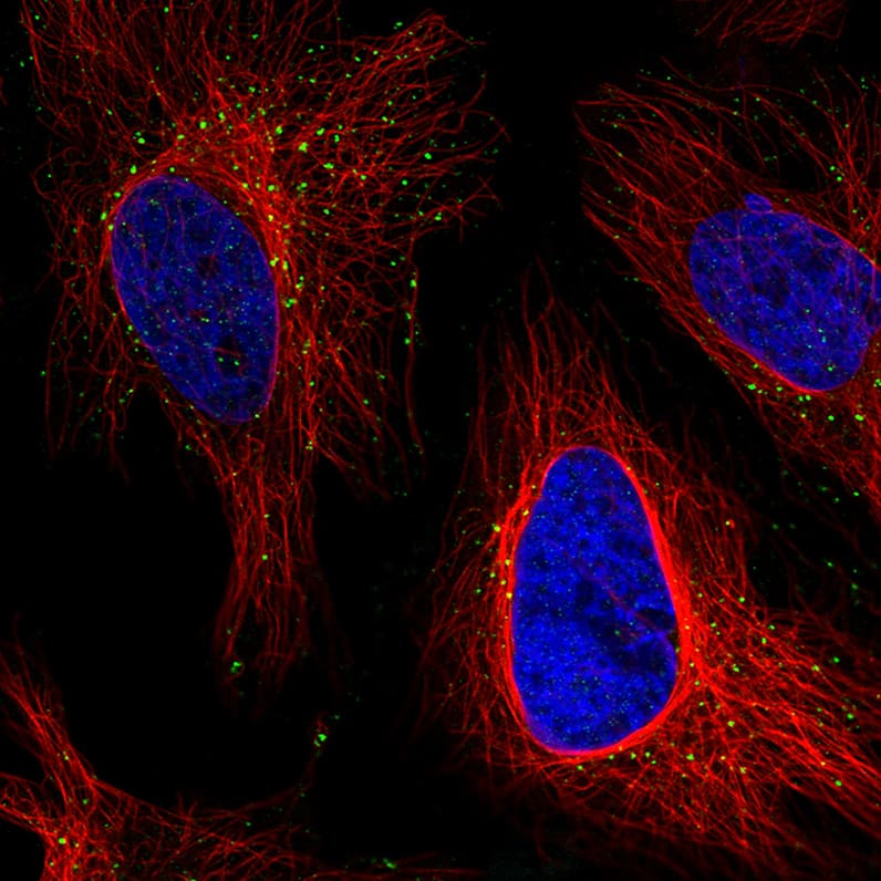 Staining in HeLa cell line with Anti-VSP26A monoclonal antibody) .