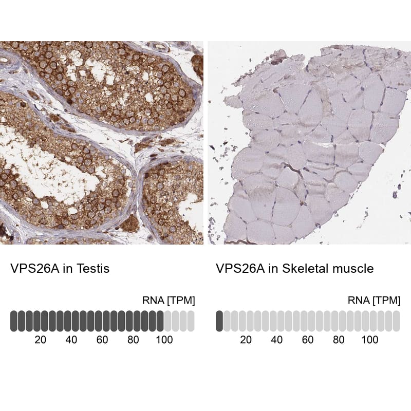 <b>Orthogonal Strategies Validation. </b>Analysis in human testis and skeletal muscle tissues using NBP3-44464 antibody. Corresponding VPS26A RNA-seq data are presented for the same tissues.