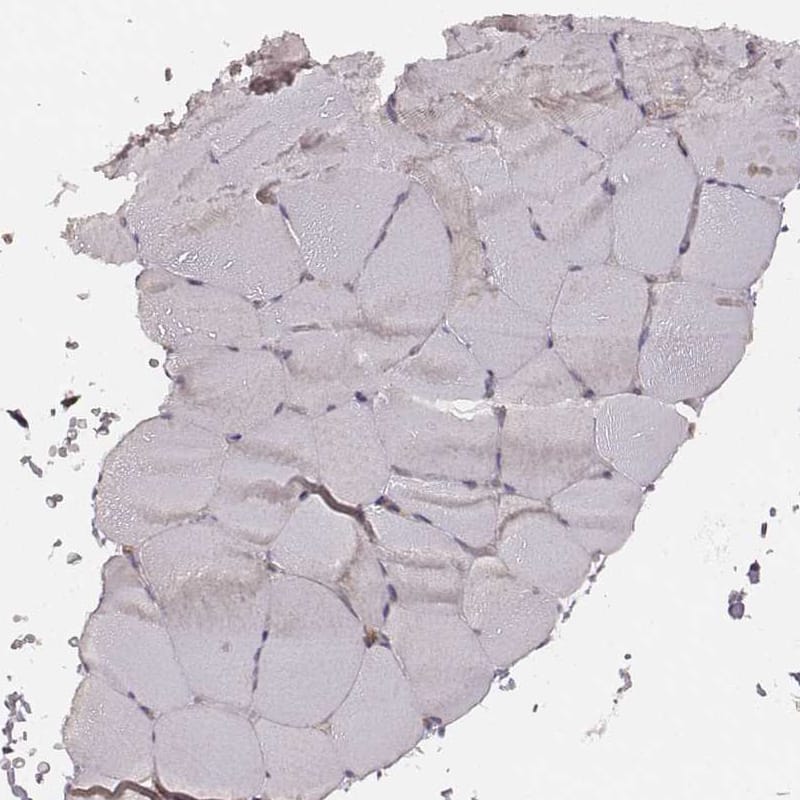 Staining of human skeletal muscle shows no positivity in striated muscle fibers as expected.
