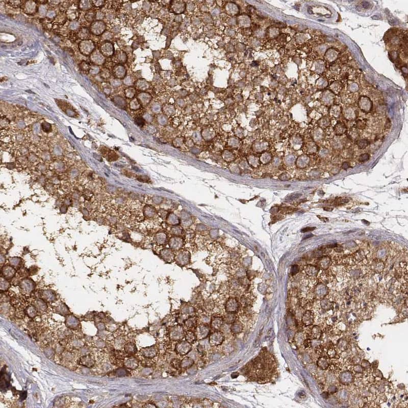 Staining of human testis shows moderate to strong cytoplasmic positivity in cells in seminiferous ducts.