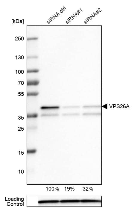 <b>Genetic Strategies Validation. </b>Analysis in U-251MG cells transfected with control siRNA, target specific siRNA probe #1 and #2, using Anti-VPS26A antibody. Remaining relative intensity is presented. Loading control: Anti-PPIB.