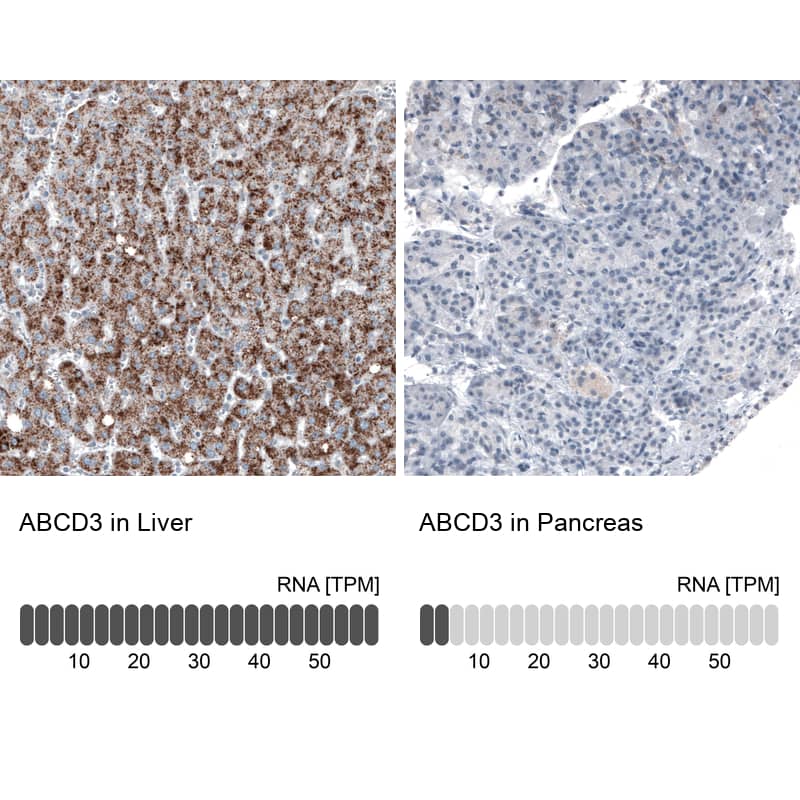 <b>Orthogonal Strategies Validation. </b>Analysis in human liver and pancreas tissues using NBP3-44465 antibody. Corresponding PMP70 RNA-seq data are presented for the same tissues.