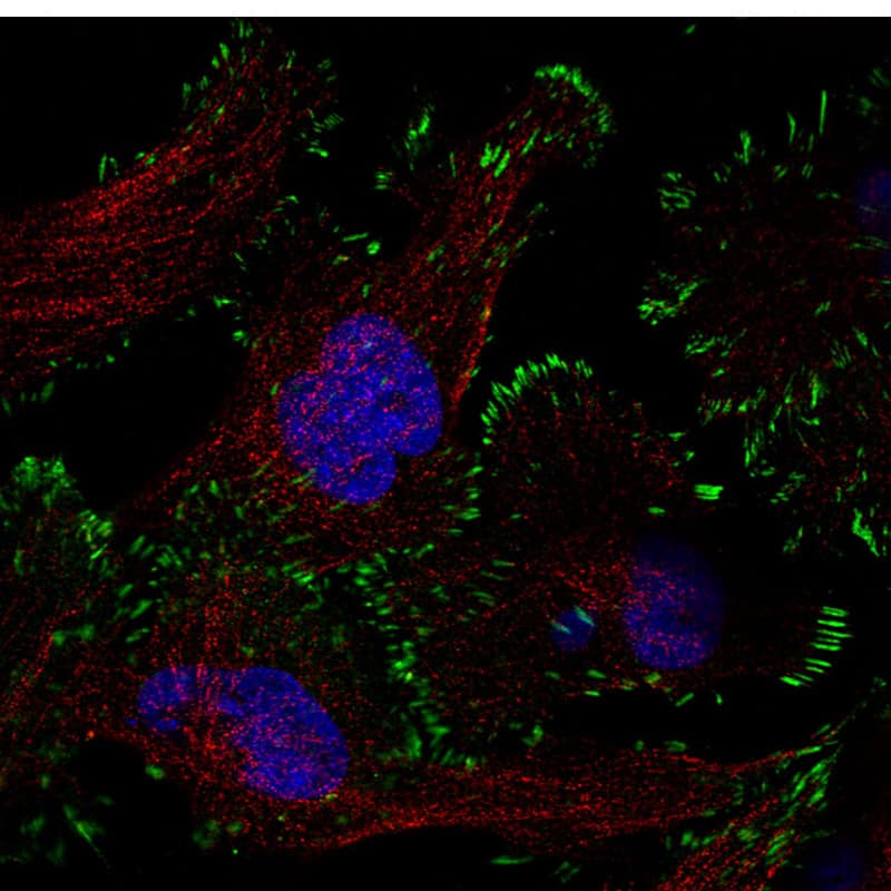 Staining in U251 cell line with Anti-Zyxin monoclonal antibody) .