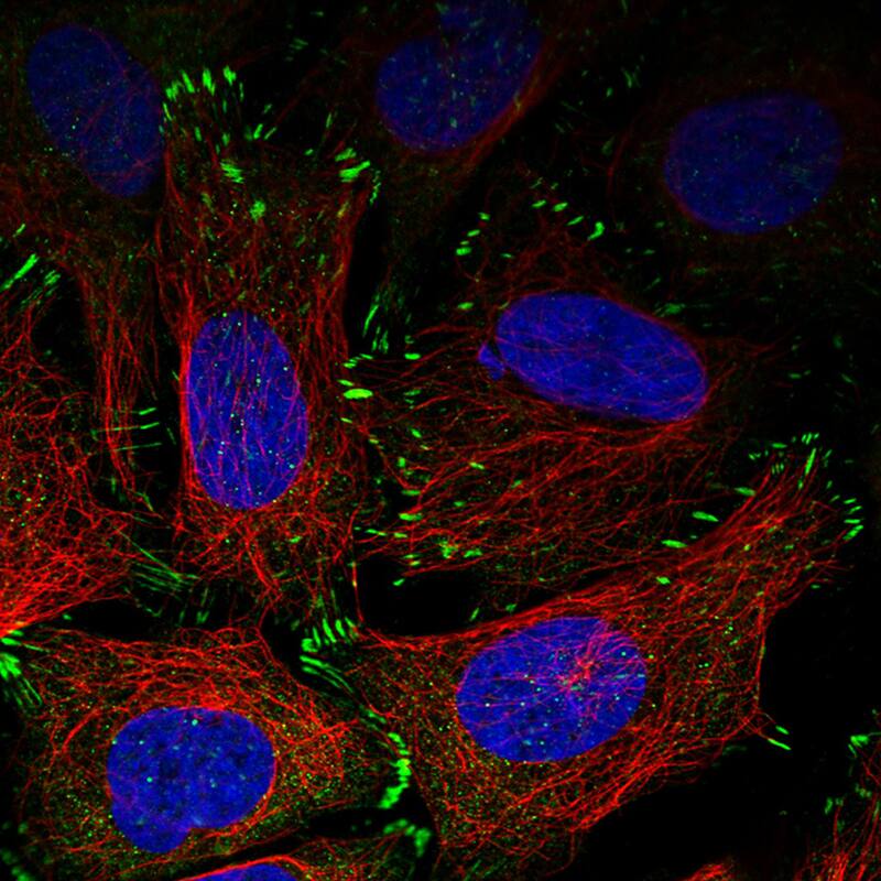 Staining in U2OS cell line with Anti-Zyxin monoclonal antibody) .