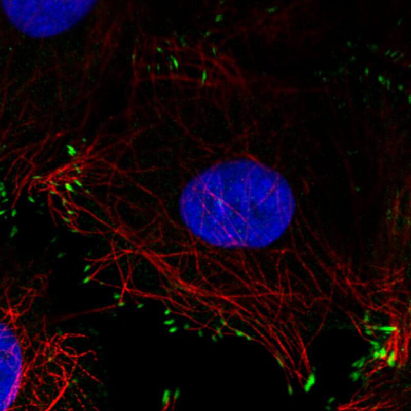 Staining in MCF7 cell line with Anti-Zyxin monoclonal antibody) .