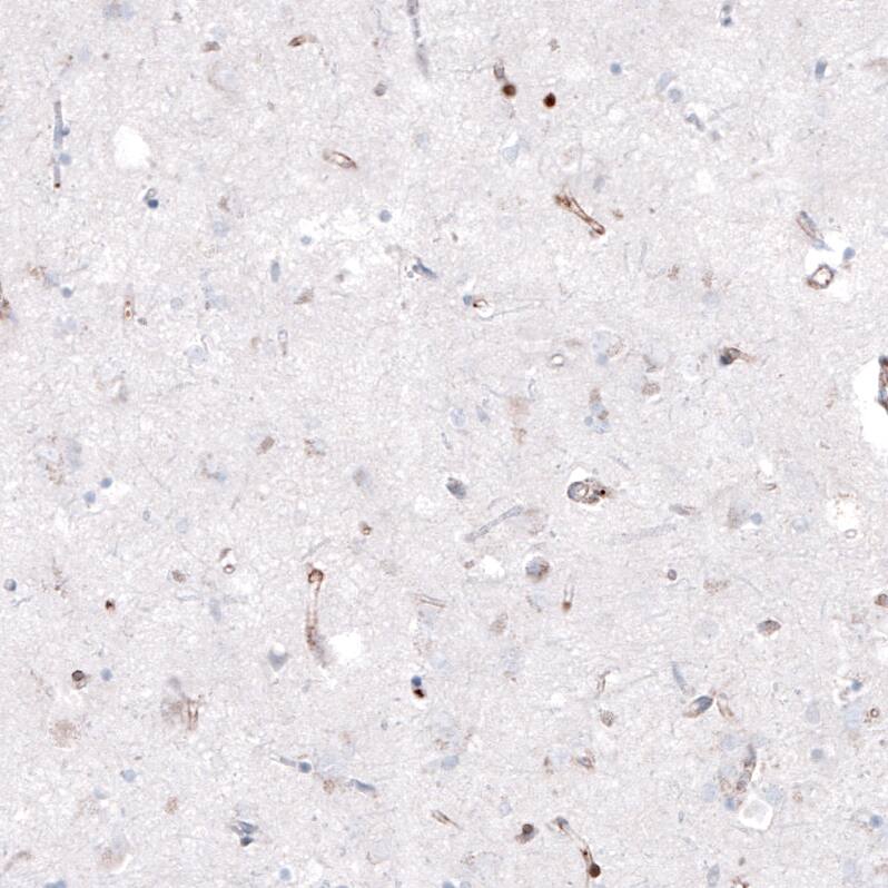 Staining of human cerebral cortex shows no positivity in neuropil as expected.