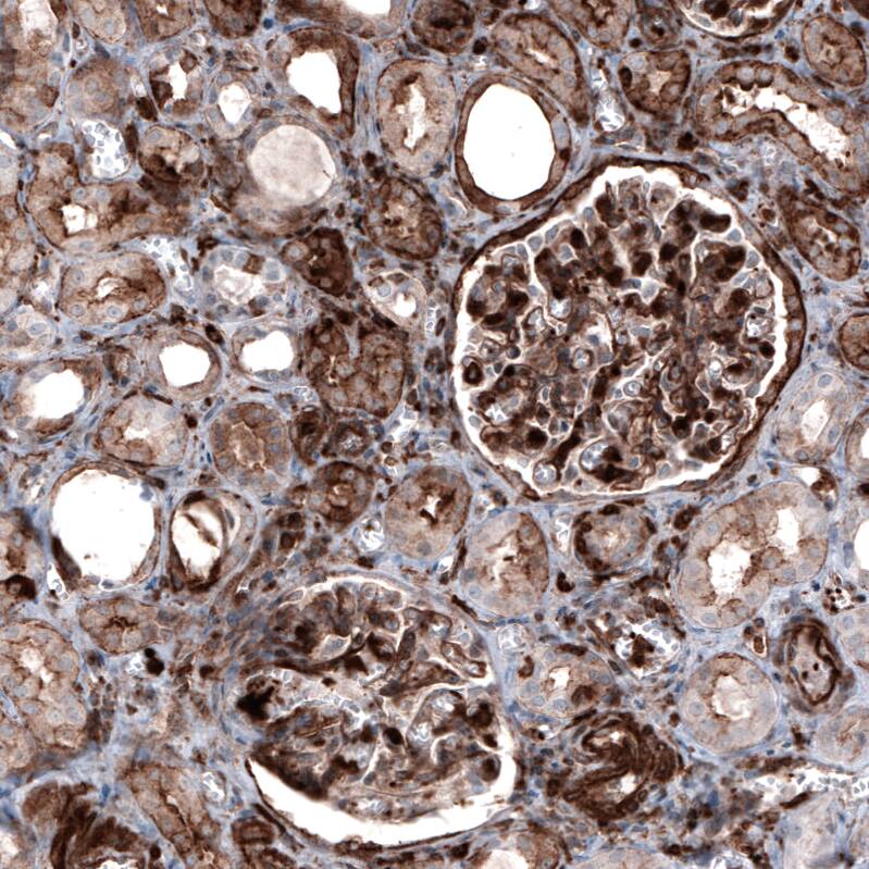Staining of human kidney shows moderate to strong cytoplasmic and membranous positivity in cells in glomeruli and in tubules.