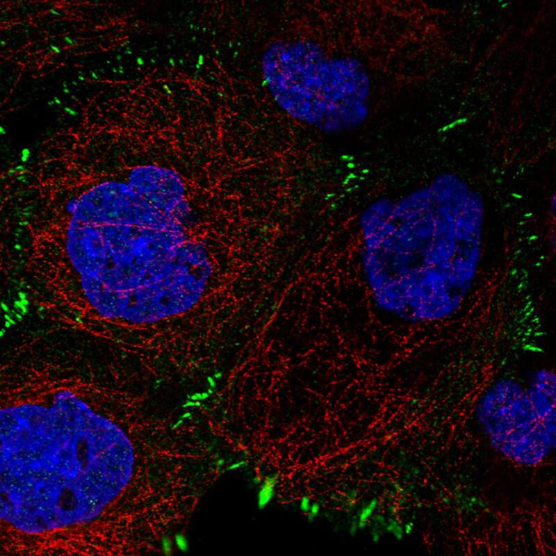 Staining in A431 cell line with Anti-Zyxin monoclonal antibody) .