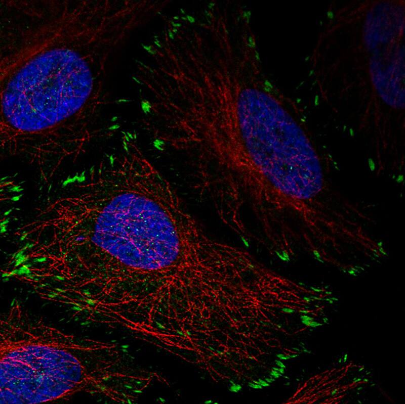 Staining in HeLa cell line with Anti-Zyxin monoclonal antibody) .