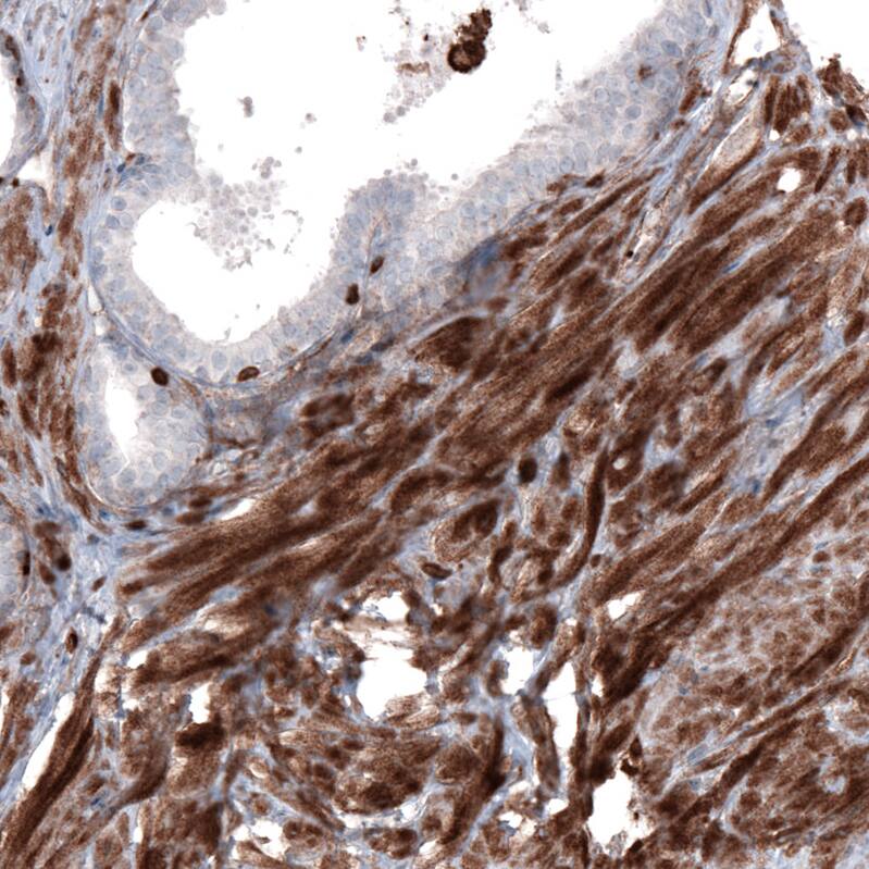 Staining of human prostate shows strong cytoplasmic positivity in smooth muscle cells.