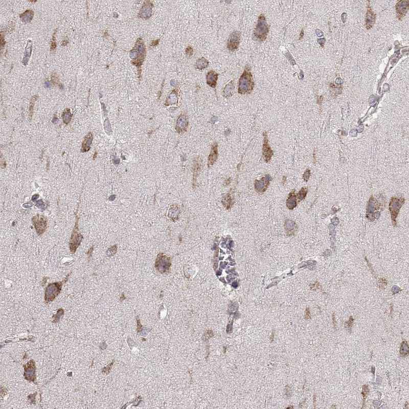 Staining of human cerebral cortex shows moderate cytoplasmic positivity in neurons.
