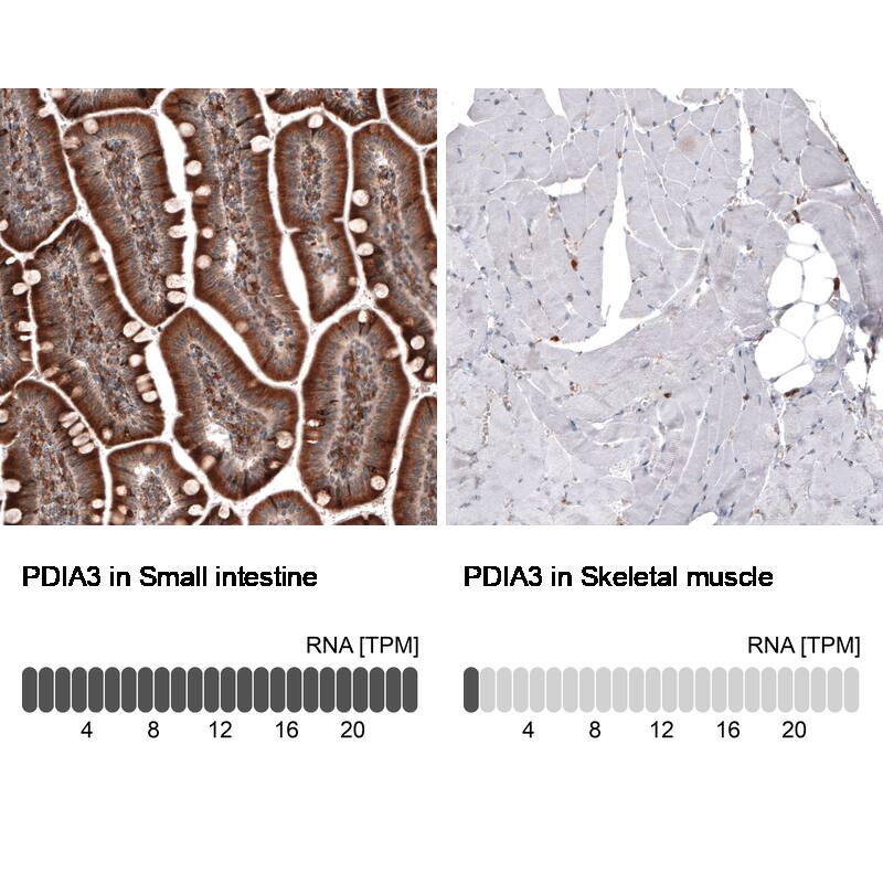 Analysis in human small intestine and skeletal muscle tissues using NBP3-44468 antibody. Corresponding ERp57/PDIA3 RNA-seq data are presented for the same tissues.