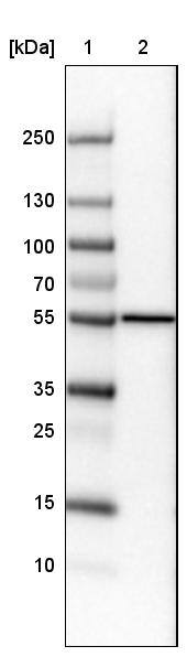 Lane 1: Marker [kDa]Lane 2:Human cell line U-251 MG