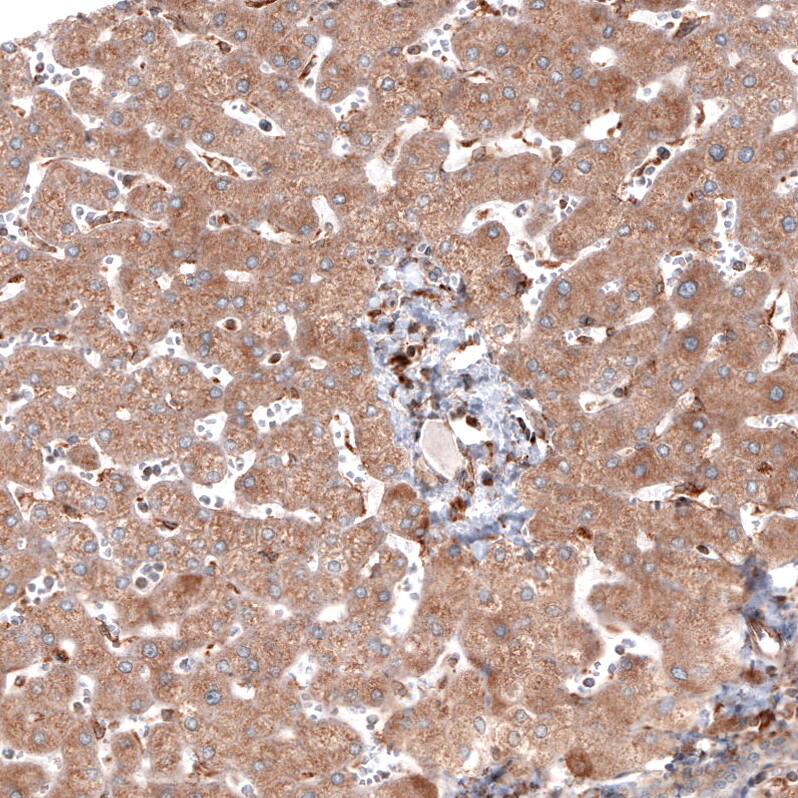Staining of human liver shows moderate cytoplasmic positivity in hepatocytes.