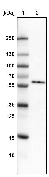 Lane 1: Marker [kDa]Lane 2: Human cell line U-251 MG