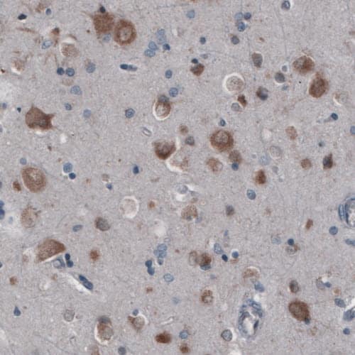 Staining of human cerebral cortex shows moderate cytoplasmic positivity in neurons.