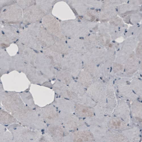 Staining of human skeletal muscle shows absence of immunoreactivity (negative control).