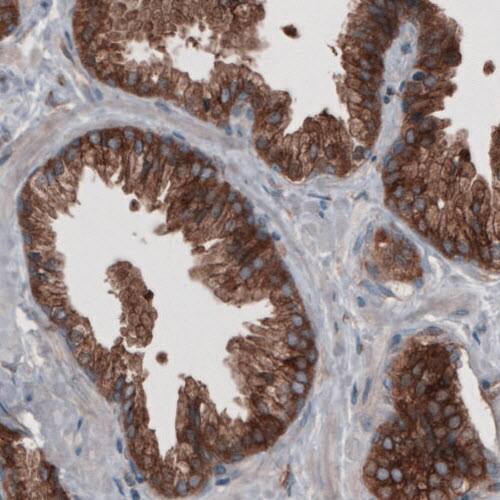 Staining of human prostate shows strong cytoplasmic positivity in glandular cells.