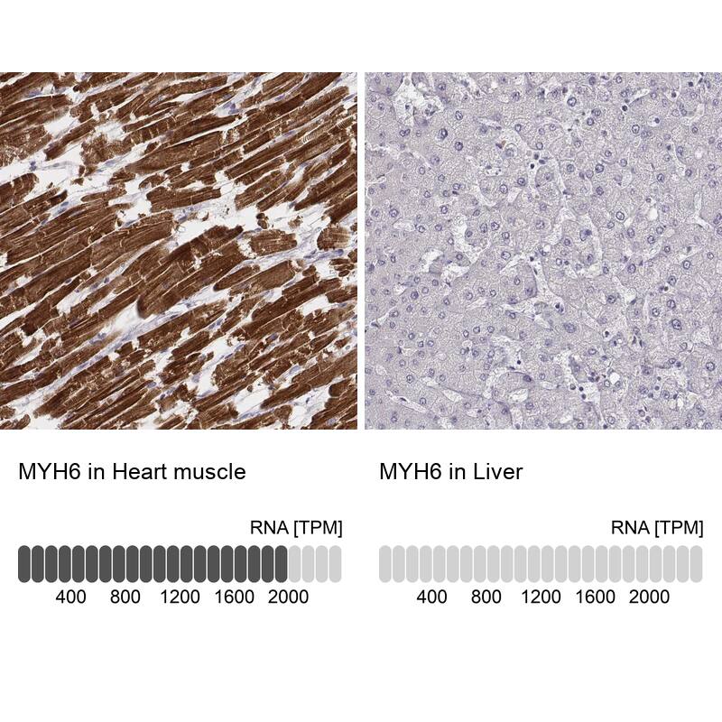 Analysis in human heart muscle and liver tissues using NBP3-44471 antibody. Corresponding MYH6 RNA-seq data are presented for the same tissues.
