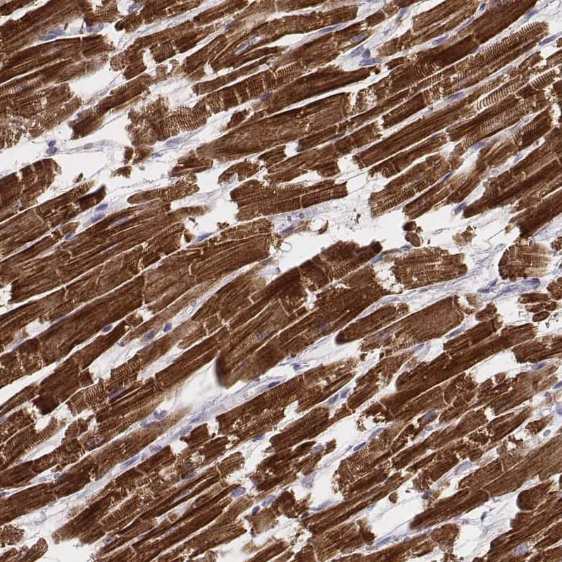 Staining of human heart muscle shows very strong cytoplasmic positivity in cardiomyocytes.