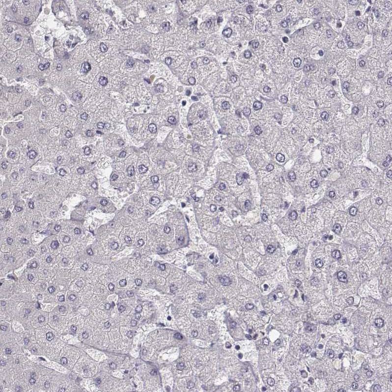 Staining of human liver shows no positivity in hepatocytes as expected.