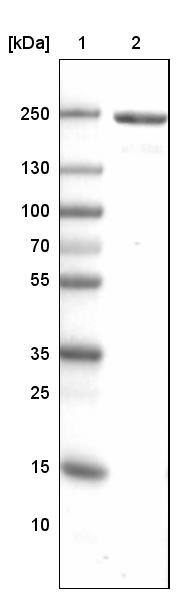 Lane 1: Marker [kDa]Lane 2: Human skeletal muscle tissue lysate