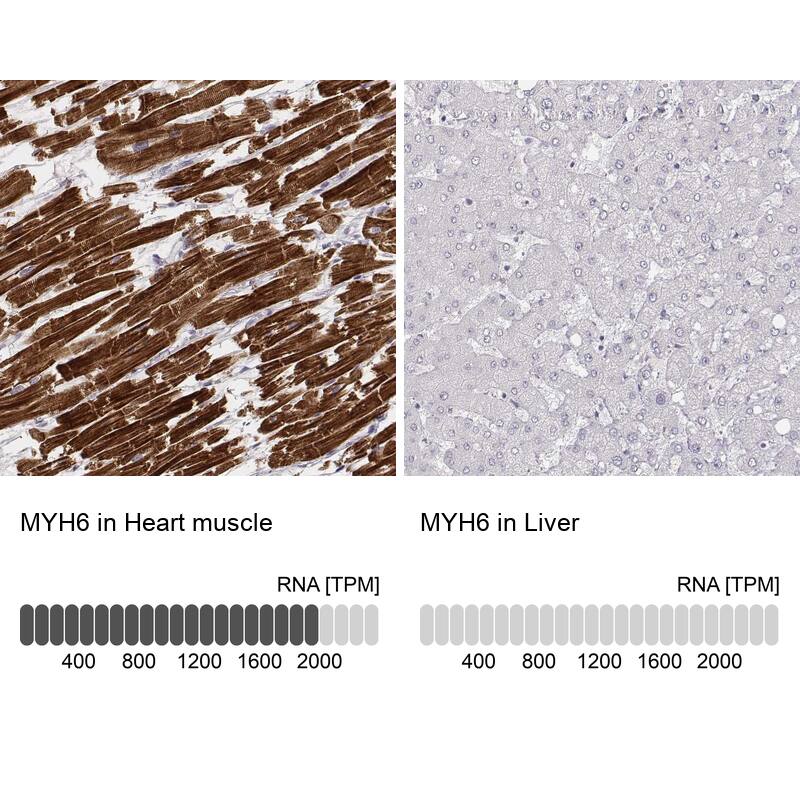 Analysis in human heart muscle and liver tissues using NBP3-44472 antibody. Corresponding MYH6 RNA-seq data are presented for the same tissues.