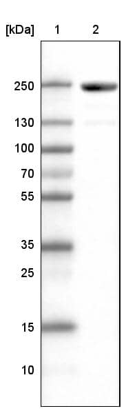 Lane 1: Marker [kDa]Lane 2: Human skeletal muscle tissue lysate