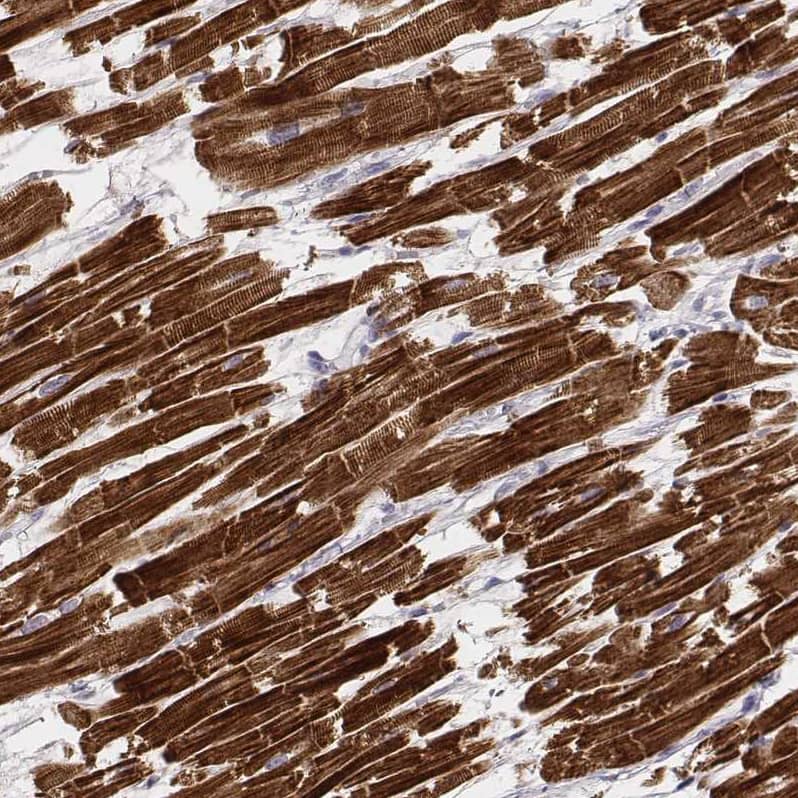 Staining of human heart muscle shows very strong cytoplasmic positivity in cardiomyocytes.