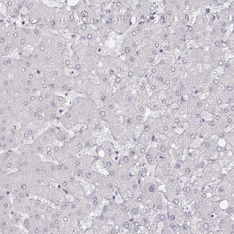 Staining of human liver shows no positivity in hepatocytes as expected.