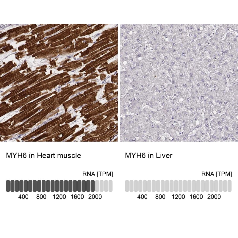 Analysis in human heart muscle and liver tissues using NBP3-44473 antibody. Corresponding MYH6 RNA-seq data are presented for the same tissues.