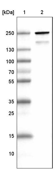 Lane 1: Marker [kDa]Lane 2: Human skeletal muscle tissue lysate
