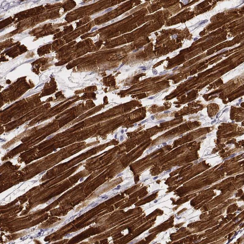 Staining of human heart muscle shows very strong cytoplasmic positivity in cardiomyocytes.