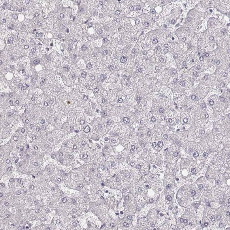 Staining of human liver shows no positivity in hepatocytes as expected.