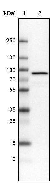 Lane 1: Marker [kDa]Lane 2: Human cell line U-251 MG