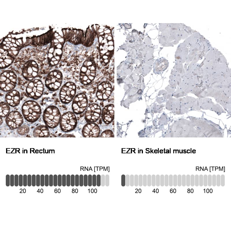 Analysis in human rectum and skeletal muscle tissues using NBP3-44474 antibody. Corresponding Ezrin RNA-seq data are presented for the same tissues.