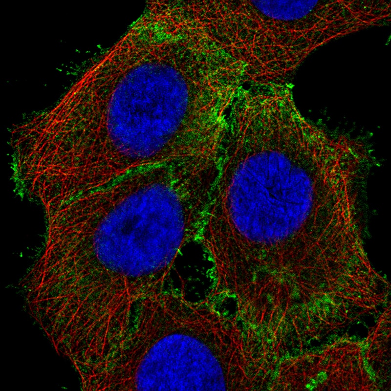Staining of A-431 cells using the Anti-Ezrin monoclonal antibody) .