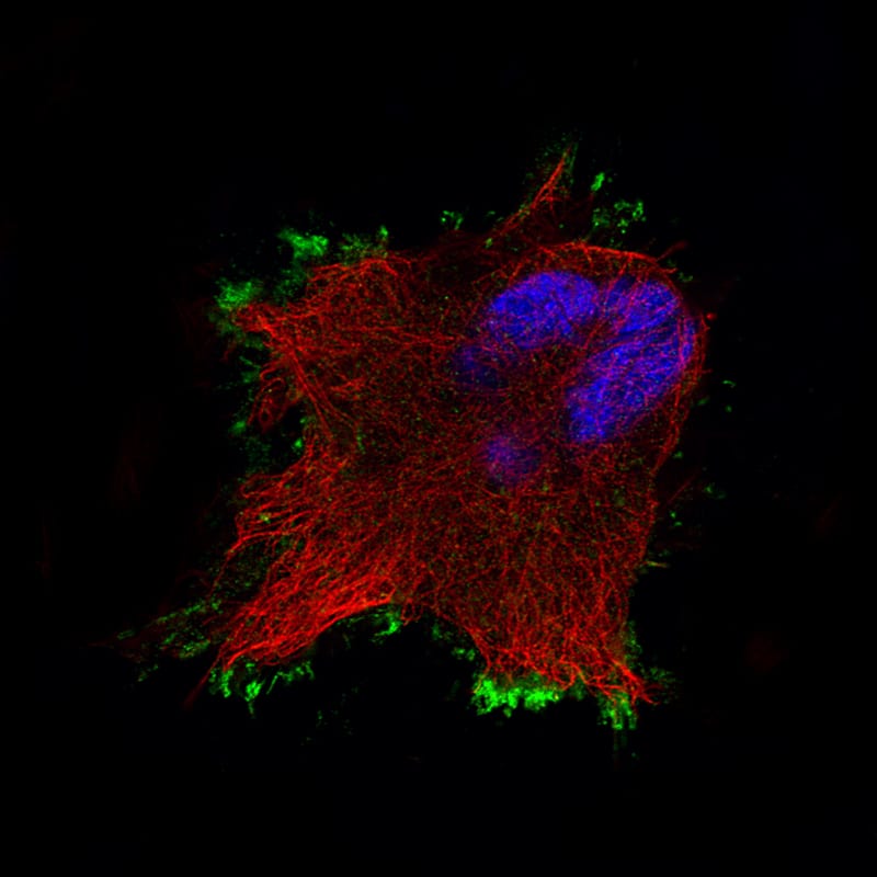 Staining of U-251 cells using the Anti-Ezrin monoclonal antibody) .