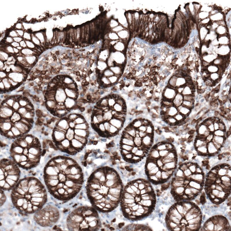 Staining of human rectum shows strong membranous positivity in glandular cells.