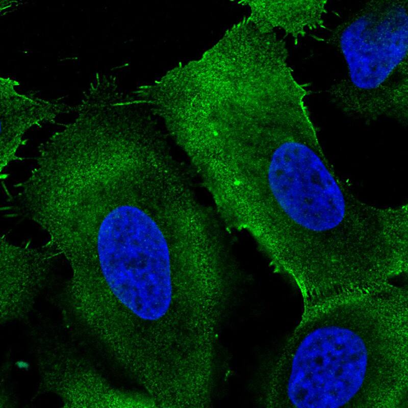 Staining in U2OS cell line with Anti-Ezrin monoclonal antibody) .