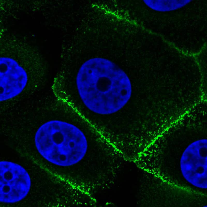 Staining in MCF7 cell line with Anti-Ezrin monoclonal antibody) .