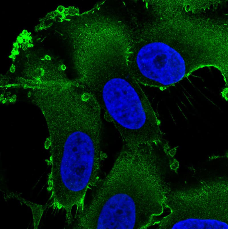 Staining in U251 cell line with Anti-Ezrin monoclonal antibody) .