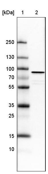 Lane 1: Marker [kDa]Lane 2: Human cell line U-251 MG